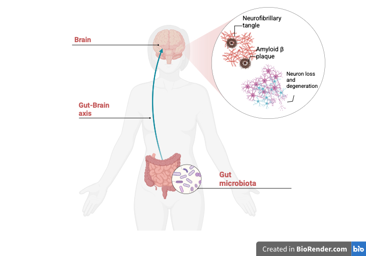 In what ways can the interconnections between the gut microbiome and ...